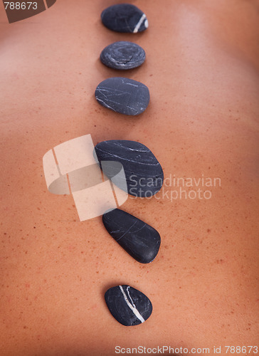 Image of Hotstone treatment