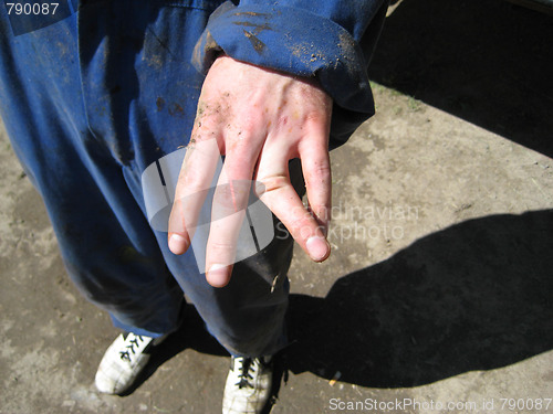 Image of Broken finger