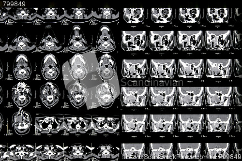 Image of Magnetic resonance of a brain