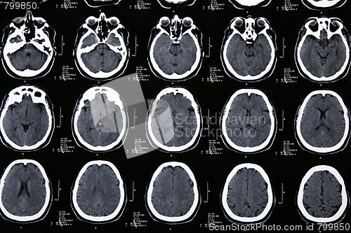 Image of Magnetic resonance of a brain