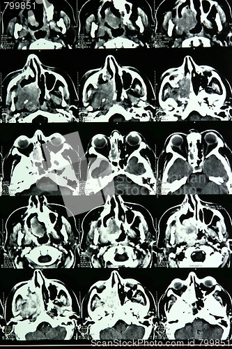 Image of Magnetic resonance of a brain