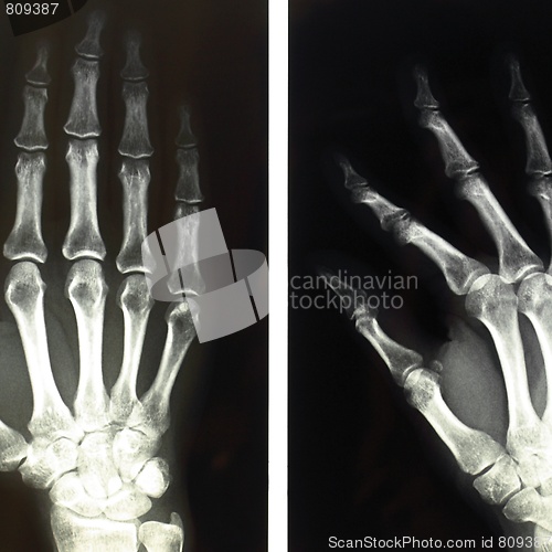 Image of Xray