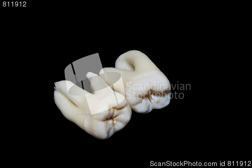 Image of extracted human teeth