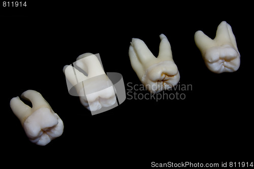 Image of extracted human teeth