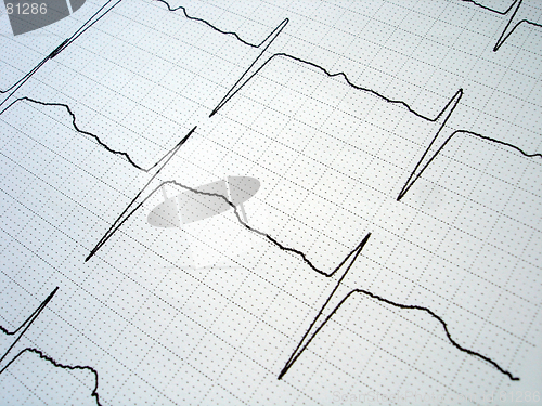 Image of EKG