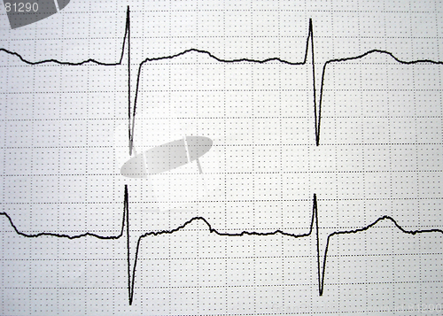 Image of EKG