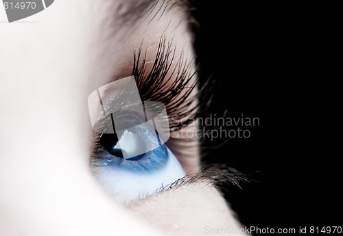 Image of Eye