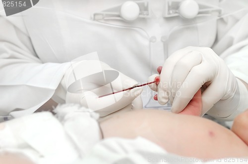 Image of newly-born child blood sampling