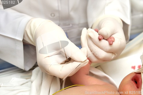 Image of newborn blood test 