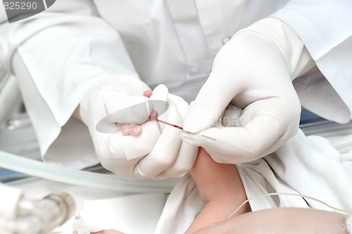 Image of newly-born child blood sampling