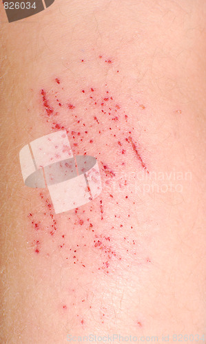 Image of injury