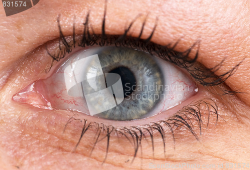 Image of Closeup of an eye