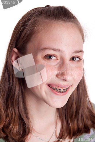 Image of Teenager With Braces