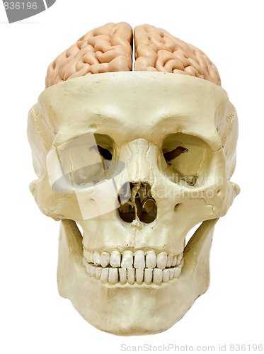 Image of Human skull with visible brain