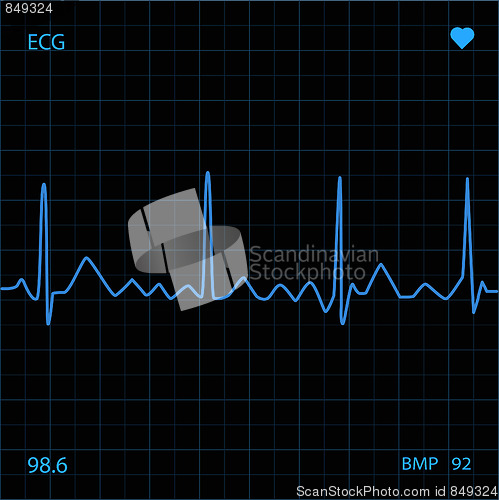 Image of Heart Monitor