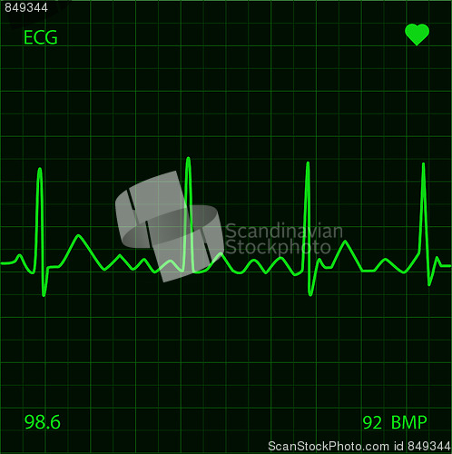 Image of Heart Monitor