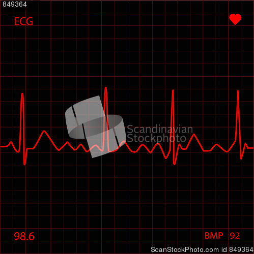 Image of Heart Monitor