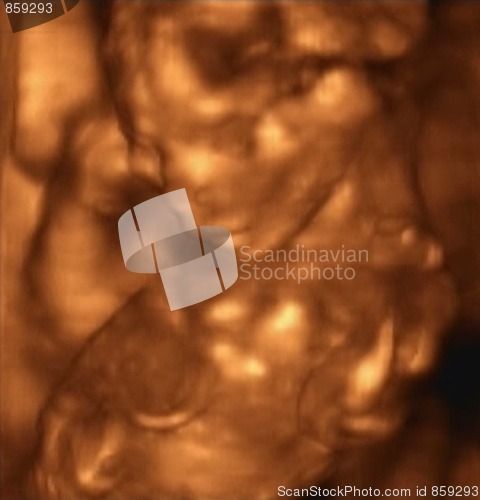 Image of Three Dimensional Ultrasound