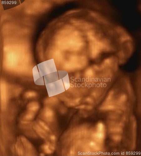 Image of Three Dimensional Ultrasound