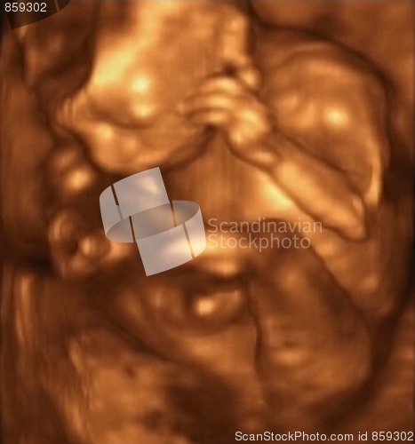 Image of Three Dimensional Ultrasound