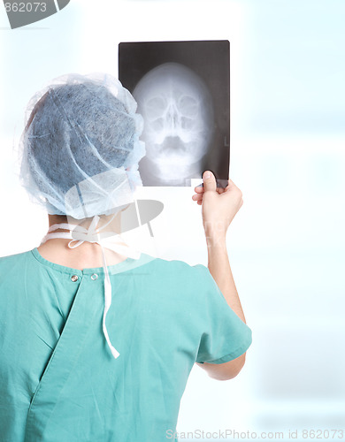 Image of doctor holding up xrays.