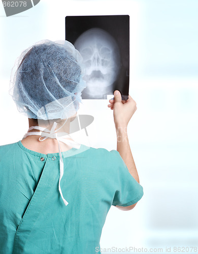 Image of doctor holding up xrays.