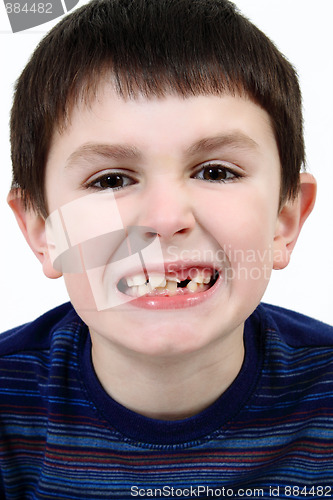 Image of Young boy grimacing