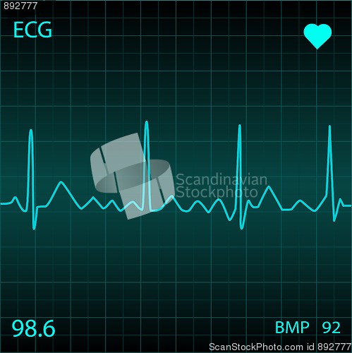 Image of Heart Monitor