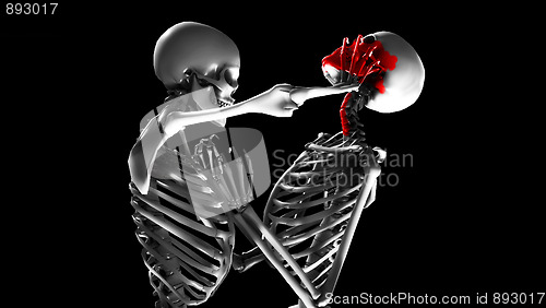 Image of Fighting Skeletons