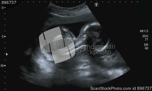 Image of Obstetric Ultrasonography