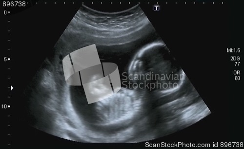 Image of Obstetric Ultrasonography