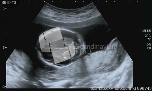 Image of Obstetric Ultrasonography