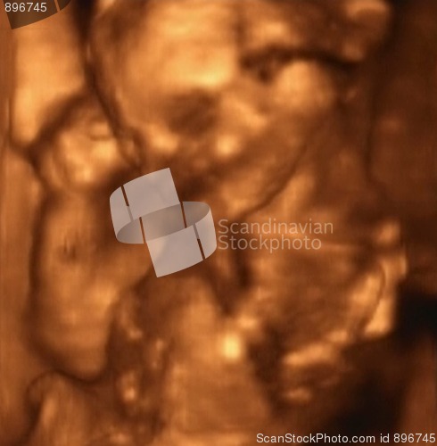 Image of Three Dimensional Ultrasound