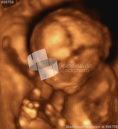 Image of Three Dimensional Ultrasound