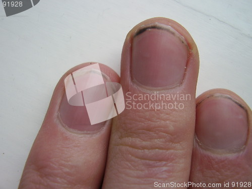 Image of nails