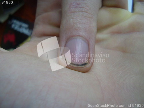 Image of nail