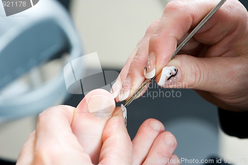 Image of Foot Therapist working on girls foot