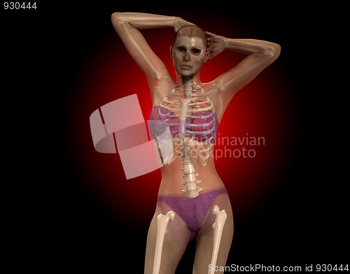 Image of X Ray Women