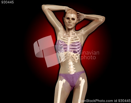 Image of X Ray Women