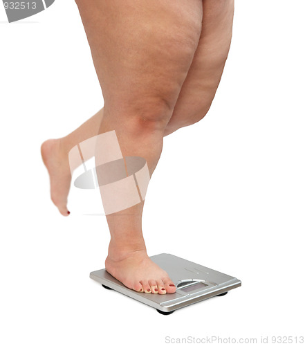 Image of women legs with overweight