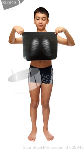 Image of boy with x-ray image of breast cage