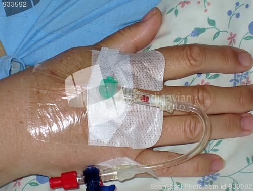 Image of Iv infusion in hand