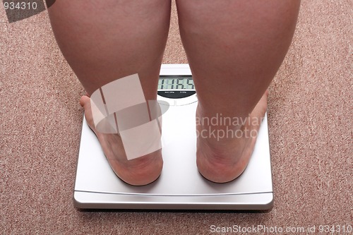 Image of women legs with overweight