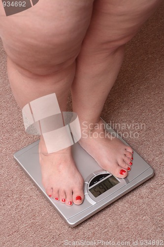 Image of women legs with overweight