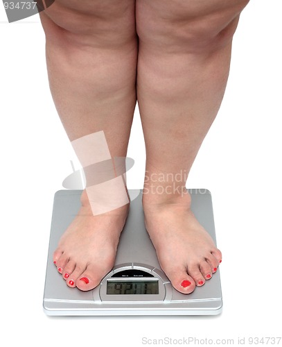 Image of women legs with overweight