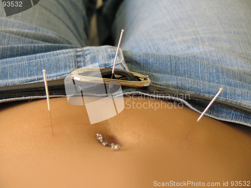 Image of Acupuncture