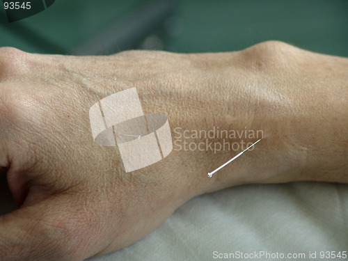 Image of Acupuncture