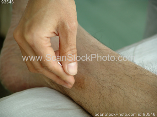 Image of Acupuncture