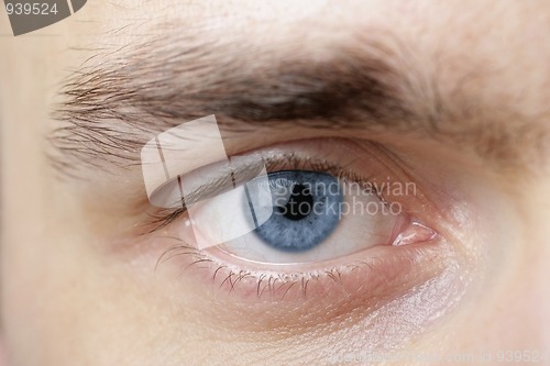 Image of Eye