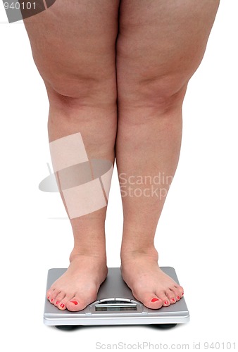 Image of women legs with overweight